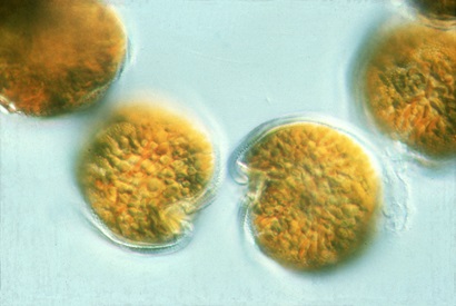 Close-up image of water sample taken from Logan’s Dam, a small body of water located near Gatton, in South East Queensland. 