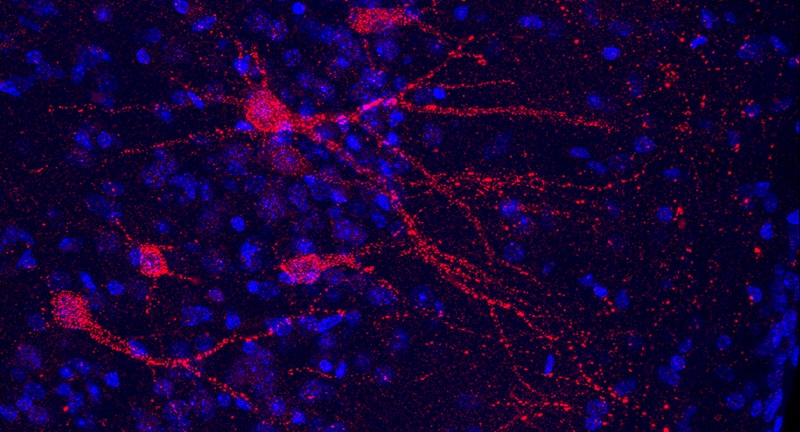 Hendra virus antigen cells shown as red dots and lines against a dark background with bright blue spots.