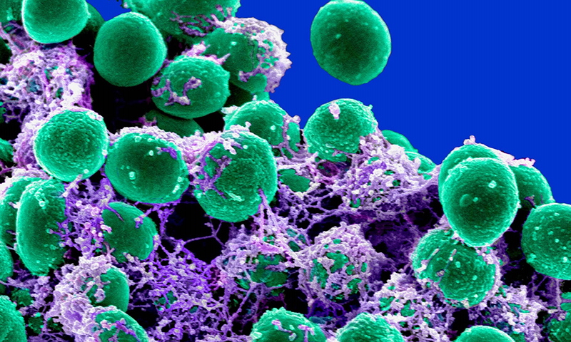 Fighting antibiotic resistance with antimicrobial RAFT polymers - CSIRO