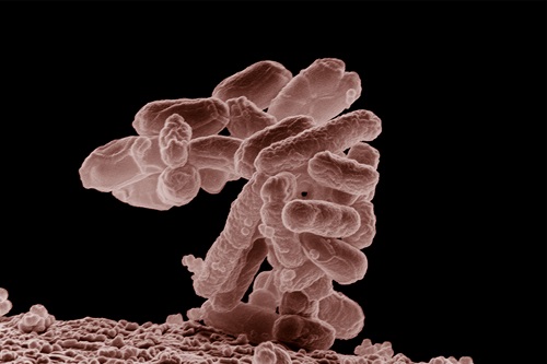 Drug resistant E. coli.