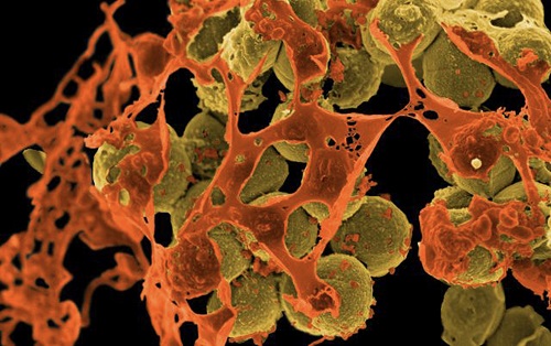 Methicillin-resistant Staphylococcus aureus (MRSA) bacteria.