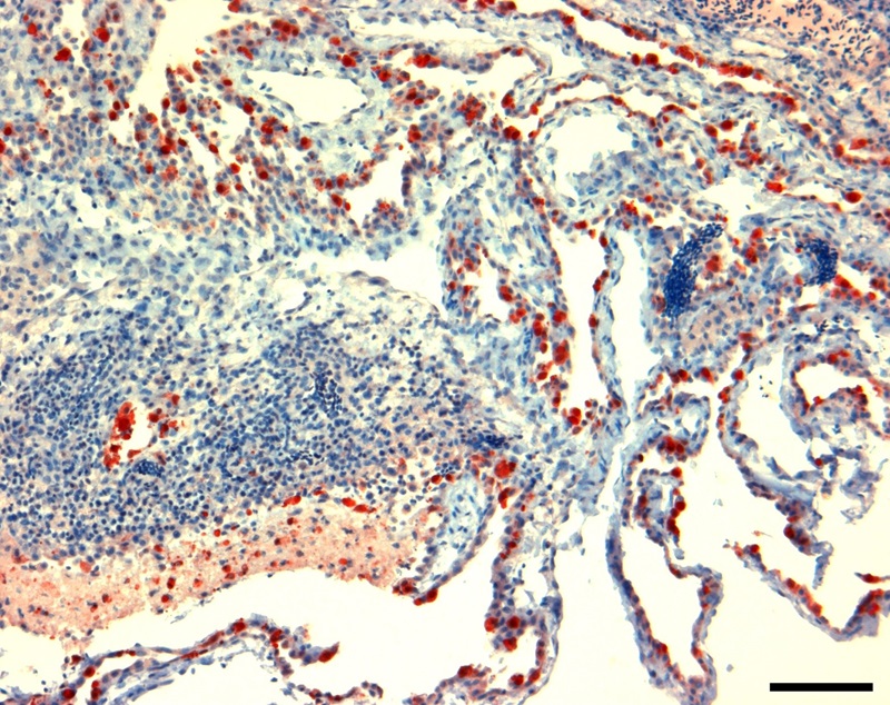 Photograph of lung respiratory tissue from a chicken infected with H5N1 bird flu.