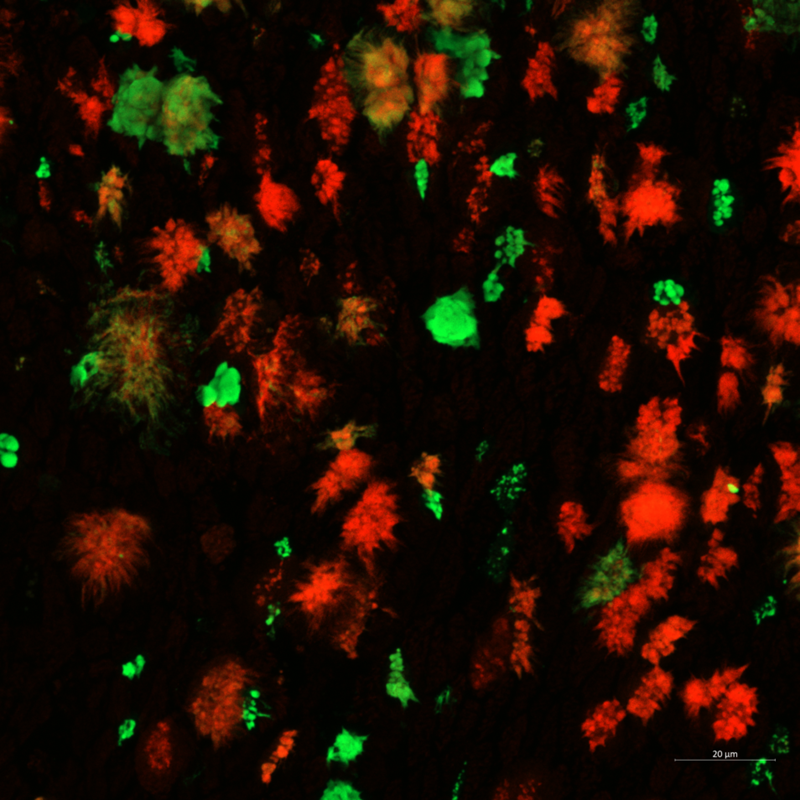 Image looking down at the surface of the airway cell cultures, shown as red and green splotches against a dark background.