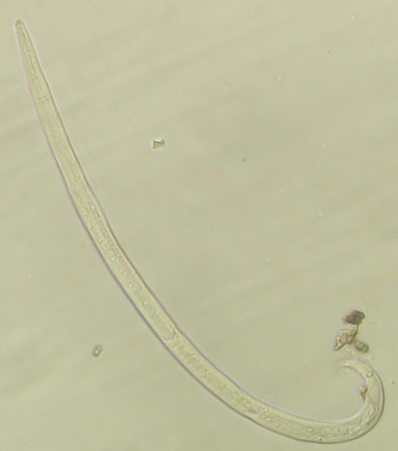 A pale background with a long, thin, translucent worm