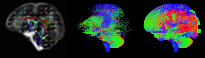 MRI visualisations of a developing brain's neural network in three stages, using diffusion imaging. Each section shows a unique perspective on brain connectivity with vivid colors, from a dotted representation on the left to dense, complex fiber patterns on the right.