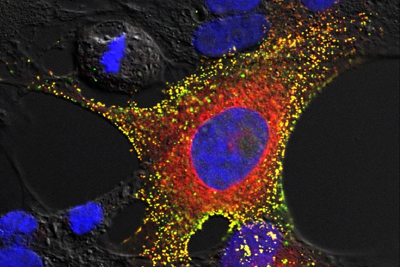 The main part of the image is a blue oval surrounded by a red ring which is all enclosed in an irregular spotted yellow shape which is an image of the hendra virus inside a bat cell.